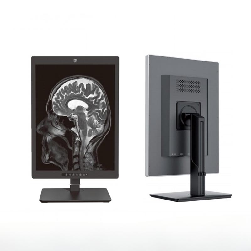 Medyczny monitor diagnostyczny o przekątnej 20,1 cala i rozdzielczości 2 MP