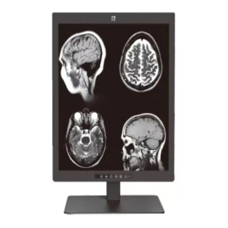 Medyczny wyświetlacz diagnostyczny o przekątnej 21,3 cala i rozdzielczości 3 MP