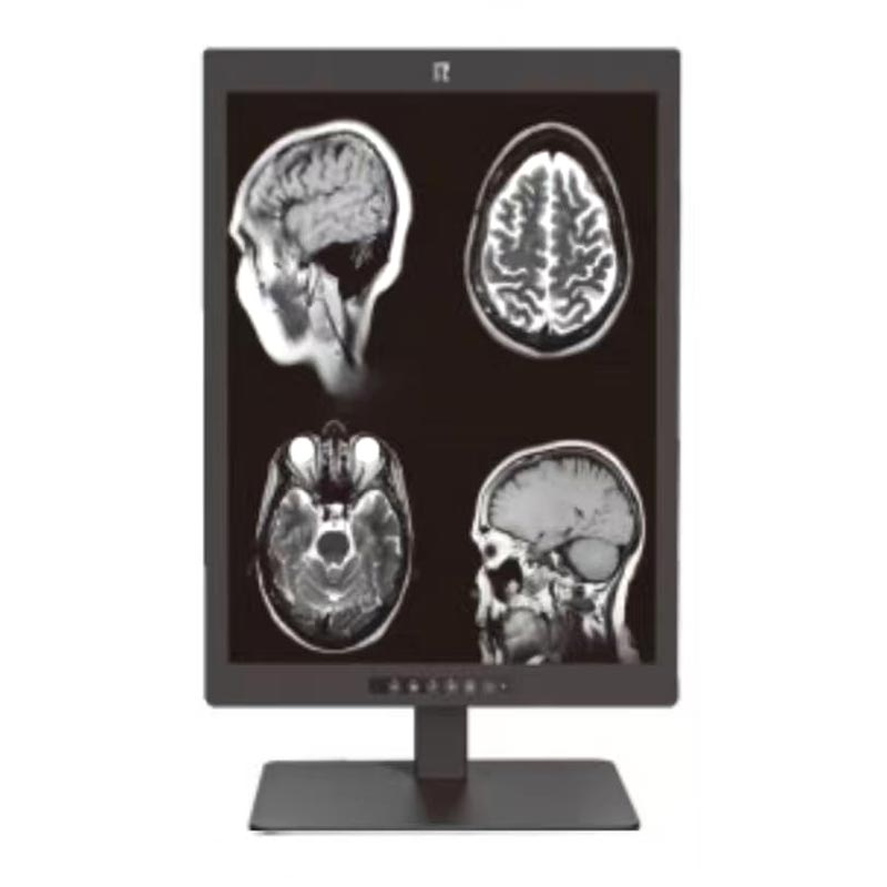 Medyczny monitor diagnostyczny o przekątnej 21,3 cala i rozdzielczości 3 MP