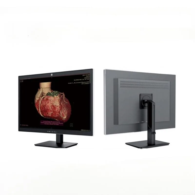 Medyczny monitor diagnostyczny o przekątnej 30 cali i rozdzielczości 6 MP