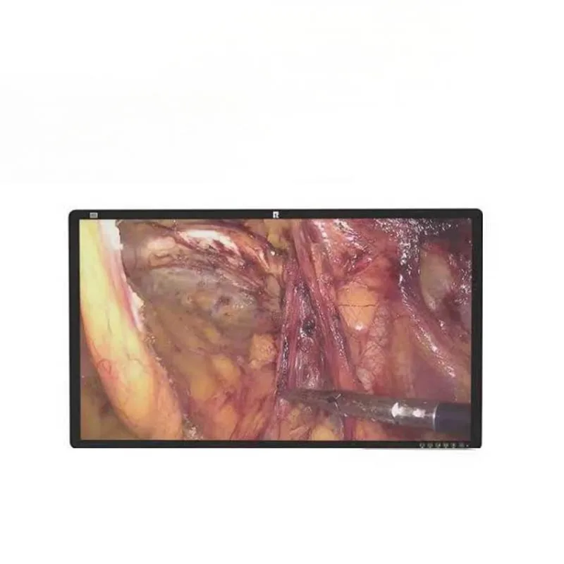 32-calowy monitor chirurgiczny 4K