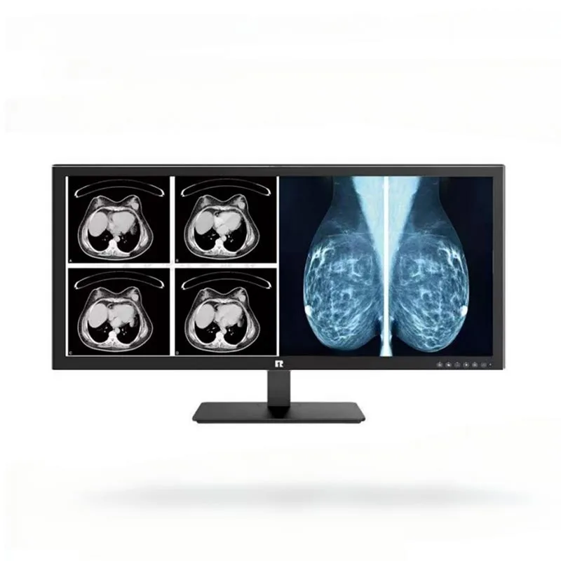 34-calowy medyczny monitor diagnostyczny o rozdzielczości 5 MP