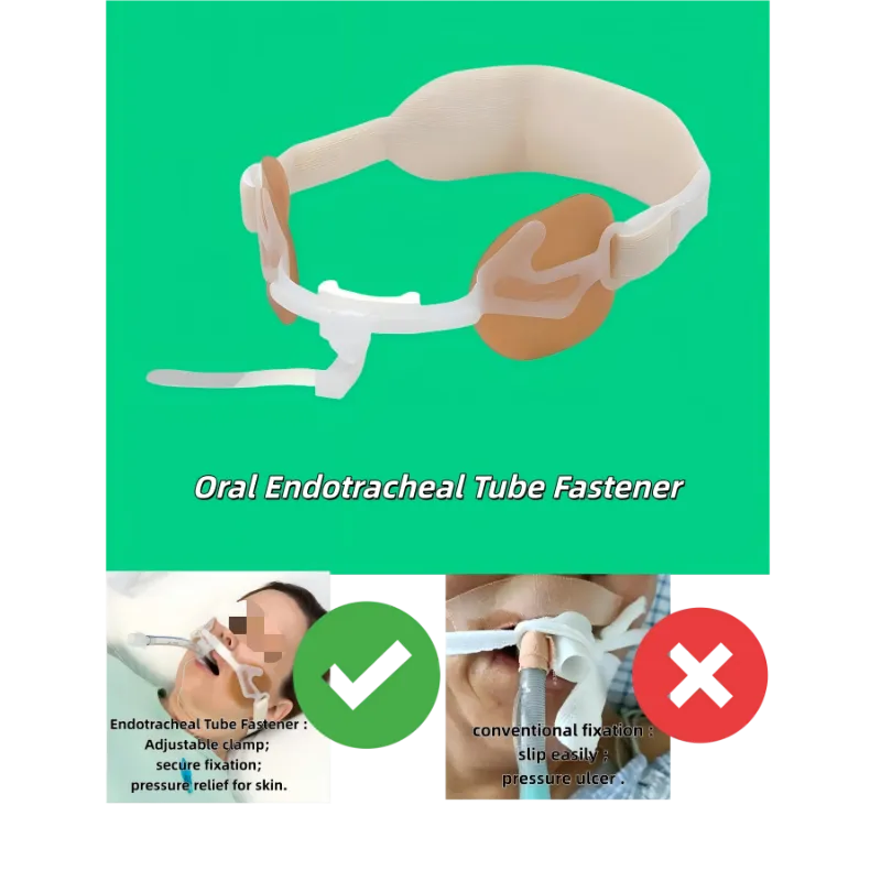 Łącznik rurki dotchawiczej