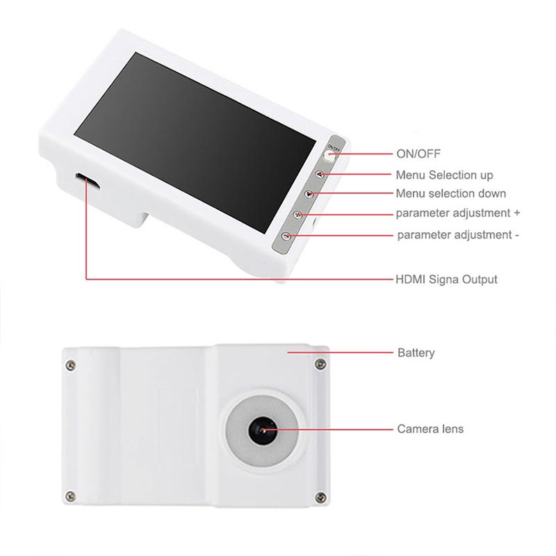 Tablet Vein Finder