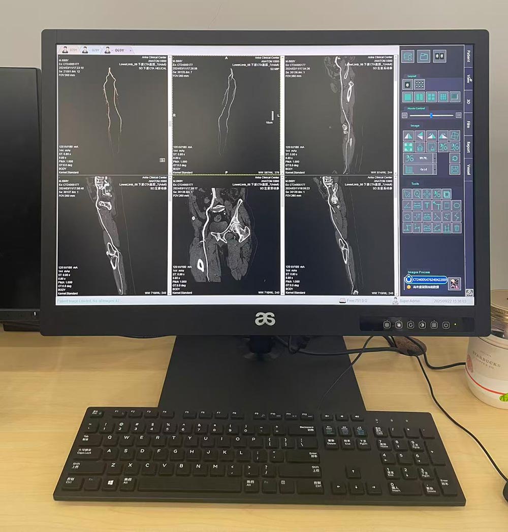27-inch 8MP Medical Diagnostic Display