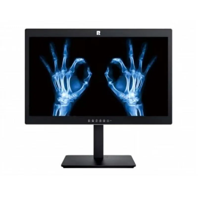 20.1-inch 2MP Medical Diagnostic Display